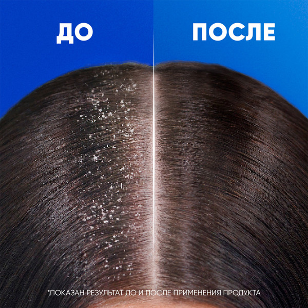 Изображение товара Шампунь для волос Head & Shoulders Против выпадения волос против перхоти для мужчин (400мл)