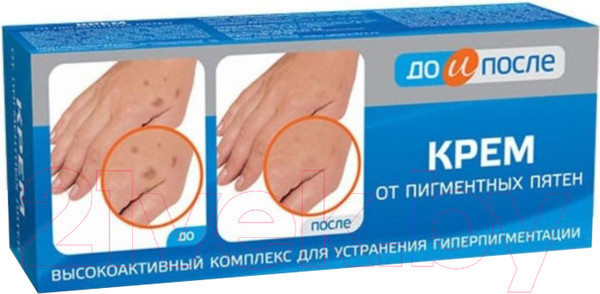Изображение товара Крем для тела До и После Против пигментных пятен (50мл)