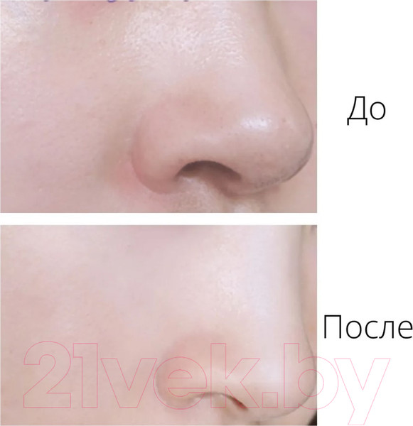 Изображение товара Гидрофильное масло Eyenlip Eggplant Pore Cleansing Oil (150мл)
