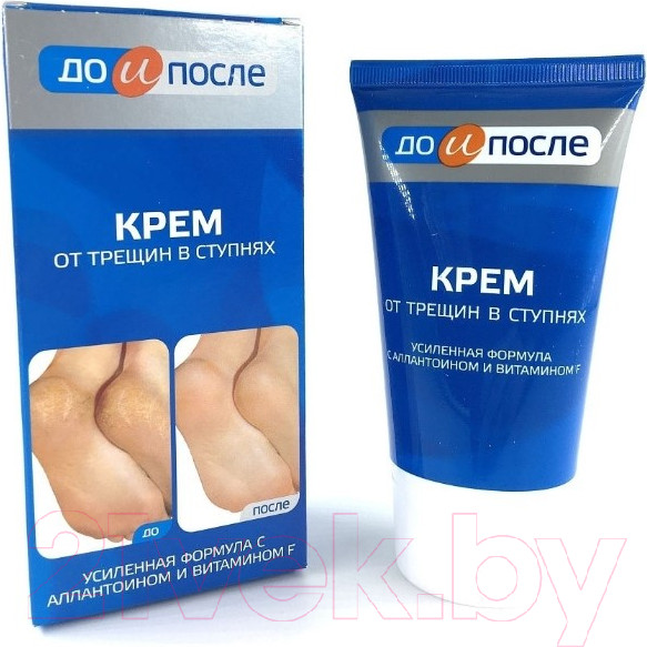 Изображение товара Крем для ног До и После От трещин в ступнях (150мл)