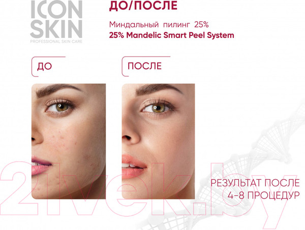 Изображение товара Пилинг для лица Icon Skin 25% Mandelic Smart Peel System (30мл)