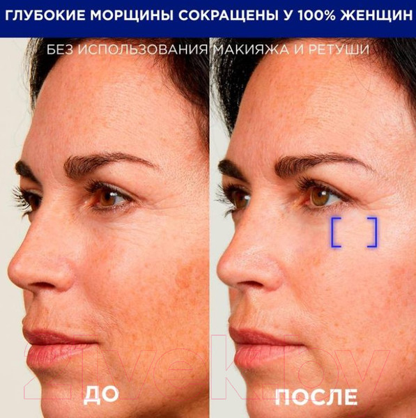 Изображение товара Набор косметики для лица L'Oreal Paris Dermo Expertise Крем 50мл+Сыворотка Ретинол ночная 30мл