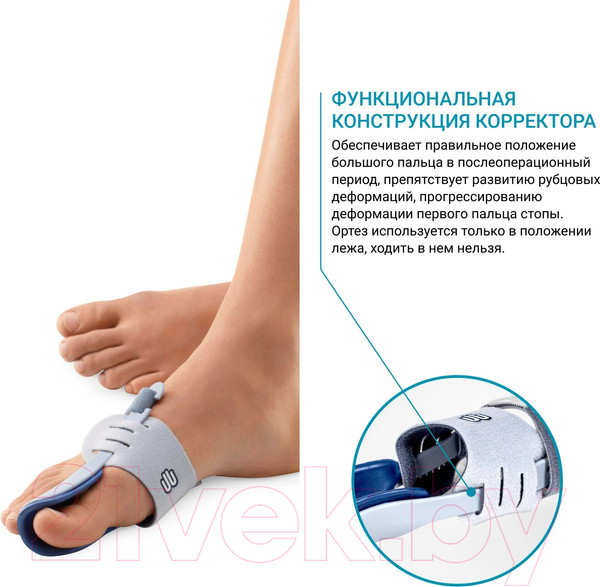 Изображение товара Корректор пальца ортопедический Bauerfeind ValguLoc (р.2, левый)