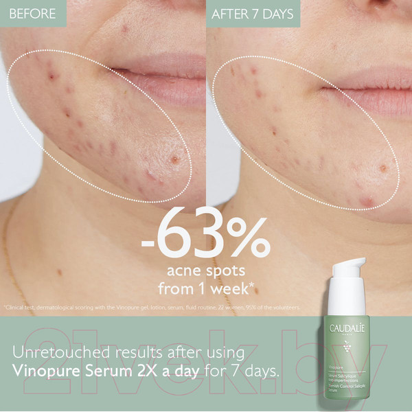 Изображение товара Сыворотка для лица Caudalie Vinopure Serum Salicylique Anti-imperfections (30мл)