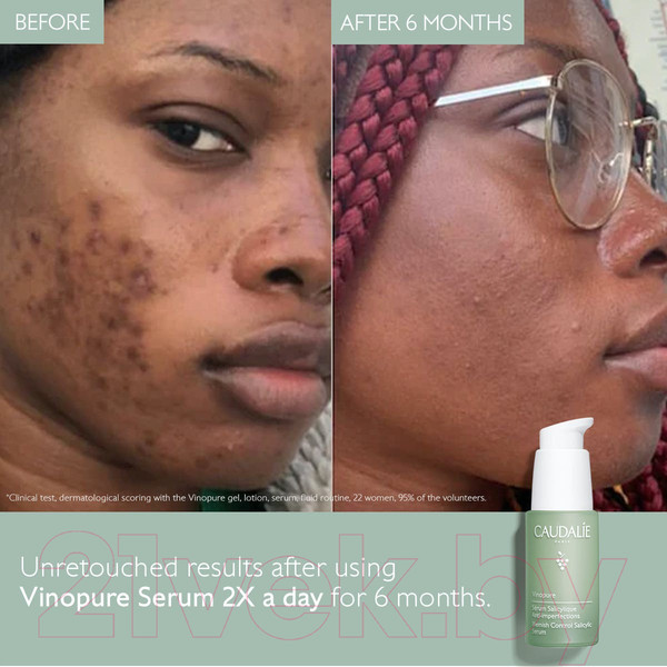 Изображение товара Сыворотка для лица Caudalie Vinopure Serum Salicylique Anti-imperfections (30мл)