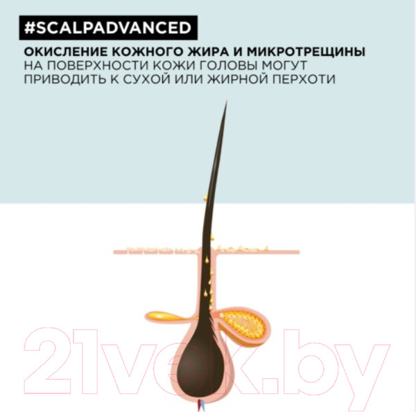 Изображение товара Шампунь для волос L'Oreal Professionnel Scalp Advanced Anti-Dandruff (300мл)