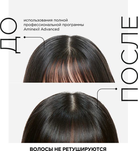 Изображение товара Сыворотка для волос L'Oreal Professionnel Aminexil Advanced для ослабленных волос против выпадения (90мл)