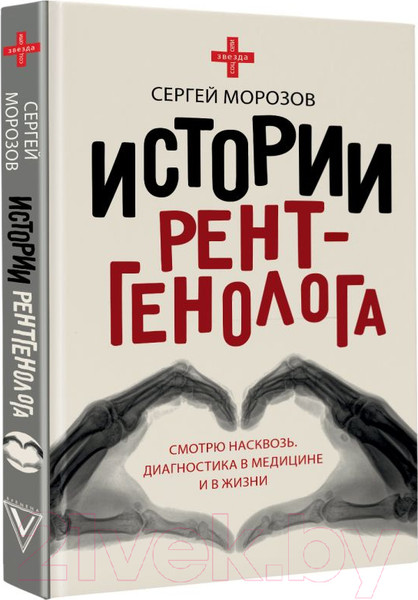 Изображение товара Книга АСТ Истории рентгенолога. Смотрю насквозь (Морозов С.П.)