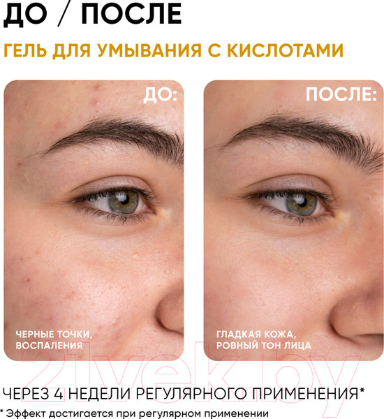 Изображение товара Гель для умывания Icon Skin AHA+BHA+PHA Soft Renew 5% (150мл)