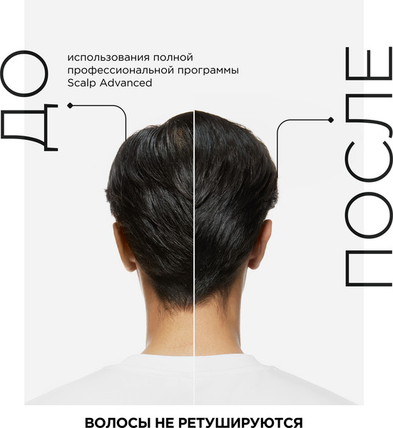 Изображение товара Шампунь для волос L'Oreal Professionnel Serie Expert Scalp Advanced Склонных к жирности (500мл)