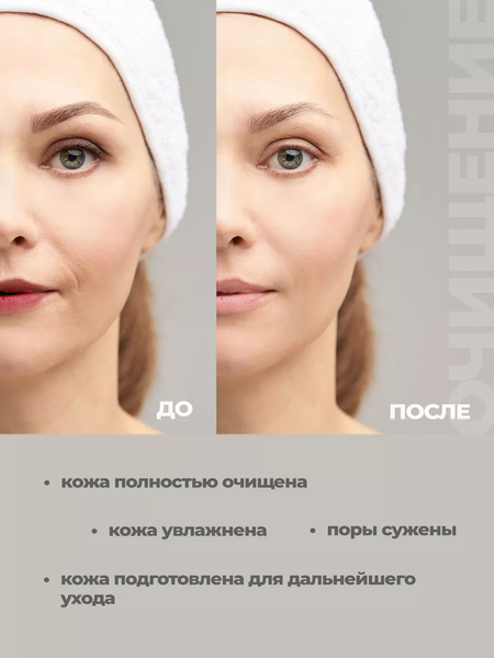 Изображение товара Тоник для лица La and Te beaute LT-1763 (53013)