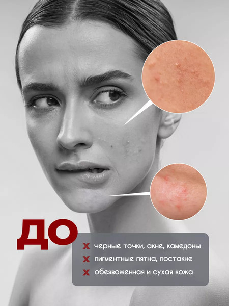 Изображение товара Пенка для умывания La and Te beaute LT-1824(53014) (150мл)