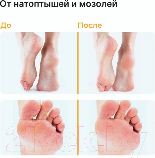 Изображение товара Крем для ног EpilProfi От трещин для очень сухой кожи (100мл)