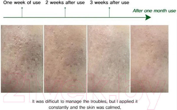 Изображение товара Крем для лица Eyenlip AC Clear Spot Для кожи склонной к акне (30мл)