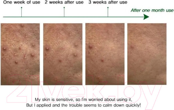 Изображение товара Крем для лица Eyenlip AC Clear Spot Для кожи склонной к акне (30мл)