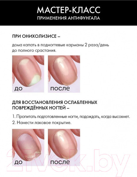 Изображение товара Средство для укрепления ногтей E.Mi Антифунгал. Стимулятор роста. Профилактика грибк. заболеваний (6мл)