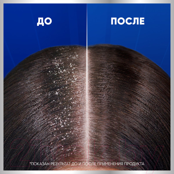 Изображение товара Шампунь для волос Head & Shoulders Против стойкой перхоти 7в1 (300мл)