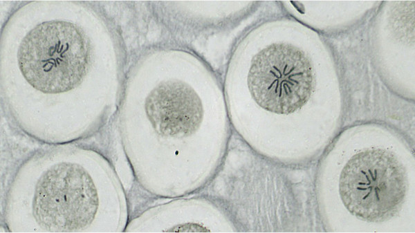Изображение товара Набор микропрепаратов Bresser 74557 (10шт, в кейсе)
