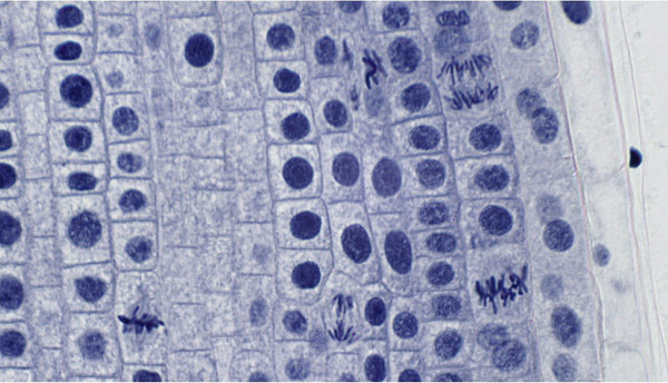 Изображение товара Набор микропрепаратов Bresser 74557 (10шт, в кейсе)