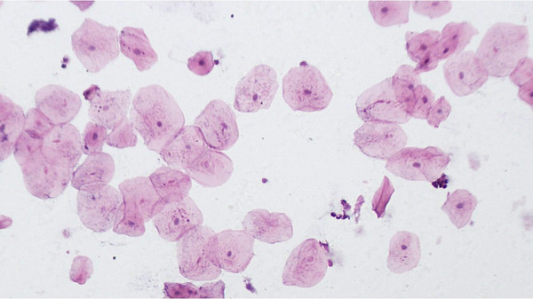 Изображение товара Набор микропрепаратов Bresser 74557 (10шт, в кейсе)