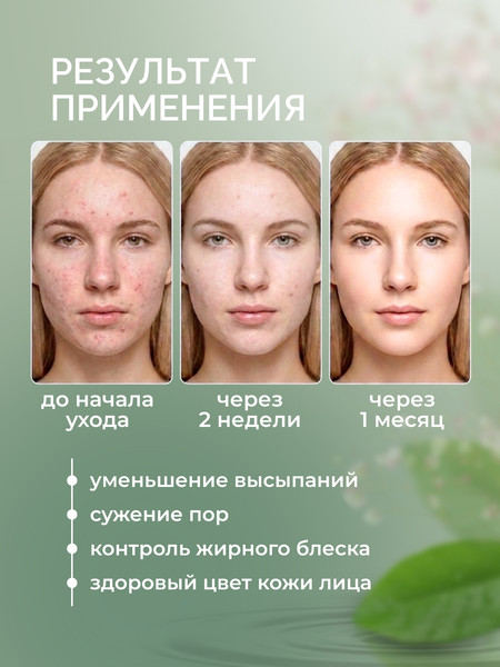 Изображение товара Сыворотка для лица Monmu Acne Corrector с каламином и ниацинамидом (50мл)