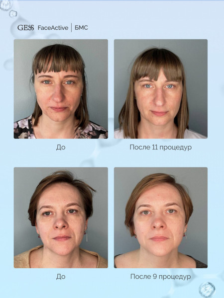 Изображение товара Массажер для лица Gess FaceActive GESS-777