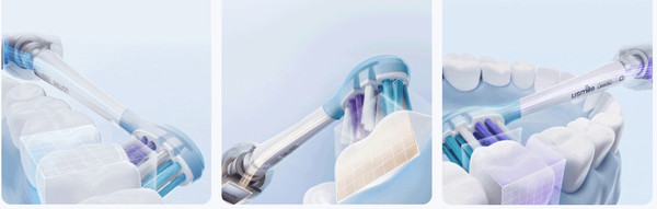 Изображение товара Звуковая зубная щетка Usmile Sonic Y10 Pro