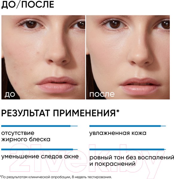 Изображение товара Крем для лица Icon Skin Moist & Heal Anti-Acne (50мл)