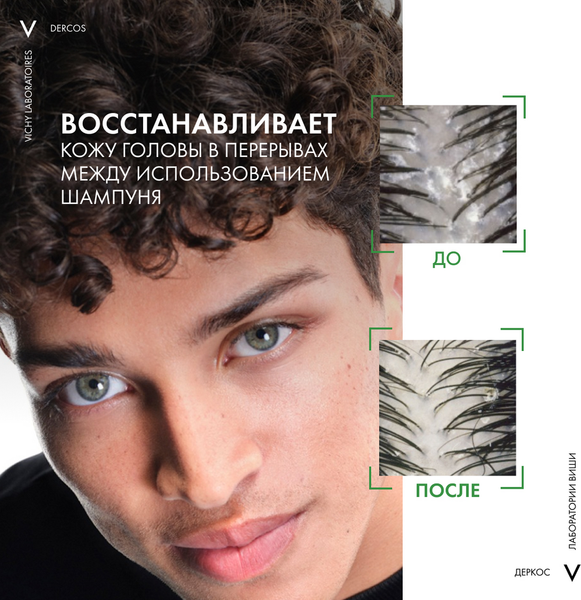 Изображение товара Сыворотка для волос Vichy Интенсивная против перхоти для кожи головы (90мл)