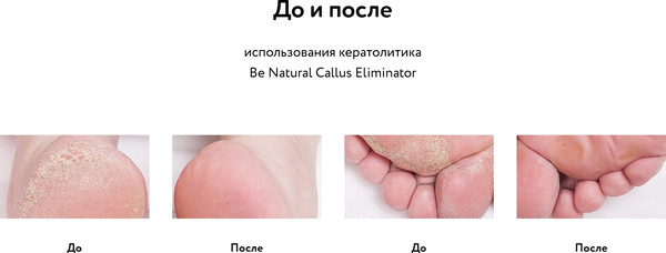 Изображение товара Кератолитик для педикюра Be Natural Callus Eliminator (50мл)