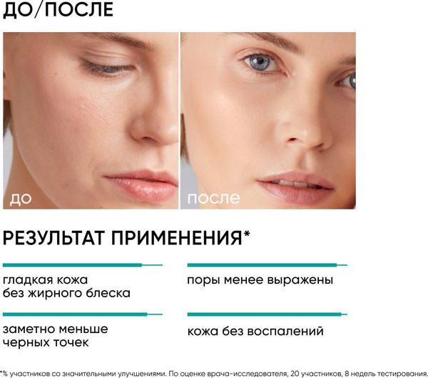 Изображение товара Пилинг для лица Icon Skin 15% AHA+BHA Peel System (30мл)