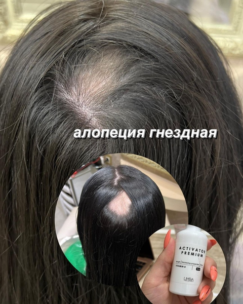 Изображение товара Сыворотка для волос Limba Cosmetics Activator Vitamin B Активатор роста волос (50мл)