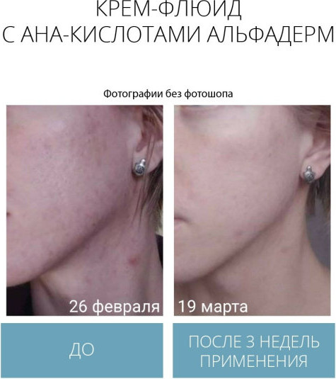 Изображение товара Флюид для лица Geltek Альфадерм Обновляющий (30мл)