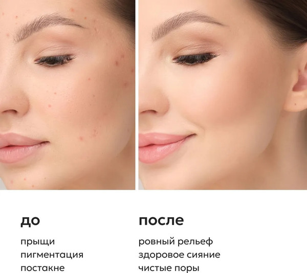 Изображение товара Набор косметики для лица Likato Professional Oil Control Skin (дой-пак)