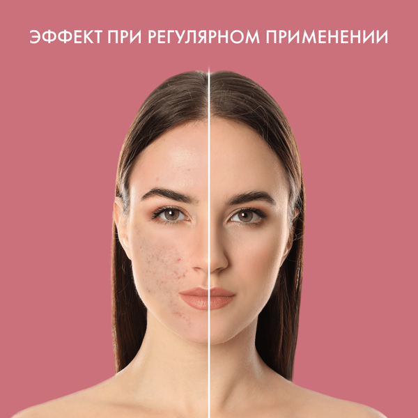 Изображение товара Крем для лица SkinpHoria Anti-Acne Skin control Корректирующий (50мл)