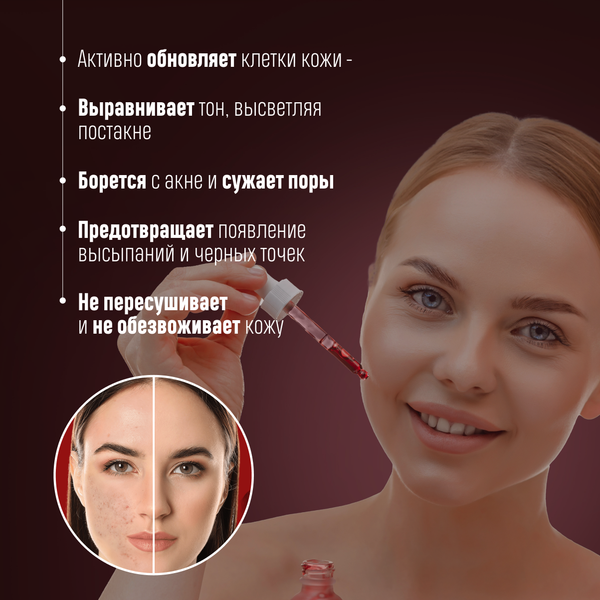 Изображение товара Пилинг для лица SkinpHoria Anti-Acne Red Blood Peeling (30мл)