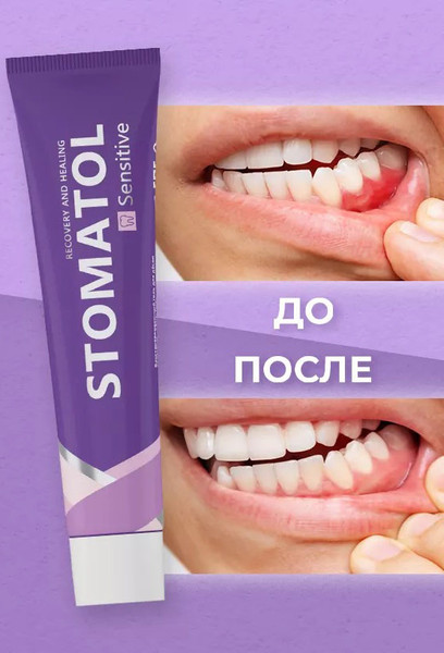 Изображение товара Гель для десен Stomatol Sensitive Восстанавливающий (50г)