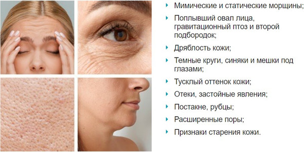 Изображение товара Импульсный массажер Gezatone M921 Biolift 1301362W