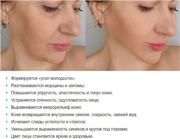 Изображение товара Импульсный массажер Gezatone M921 Biolift 1301362W