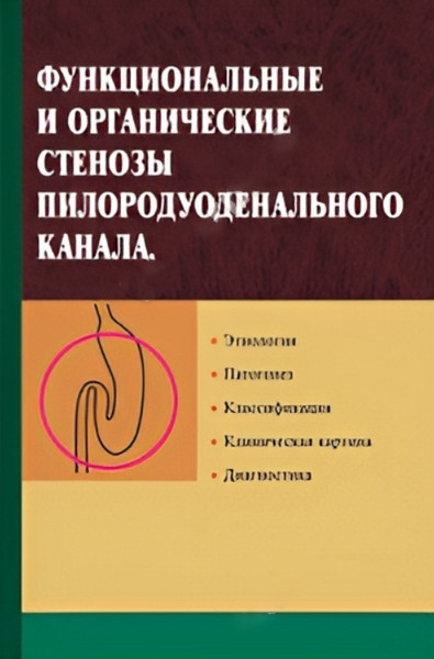 Изображение товара Учебное пособие Вышэйшая школа Функциональные и органичес. стенозы пилородуодненального канала (Гришин Игорь)