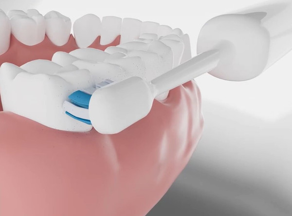 Изображение товара Электрическая зубная щетка TECHNO Swing&Vibra TB01