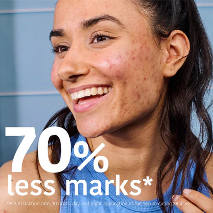 Изображение товара Сыворотка для лица Iroha Nature Serum Prevent & Correct Anti-Blemish (30мл)