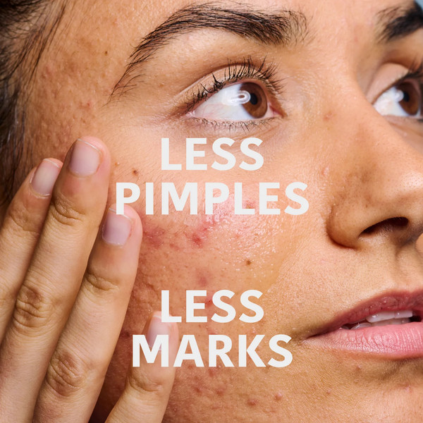 Изображение товара Сыворотка для лица Iroha Nature Serum Prevent & Correct Anti-Blemish (30мл)