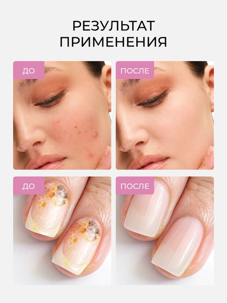 Изображение товара Масло для лица Mariee Экстракт монарды CO2 для кожи, волос, ногтей (30мл)