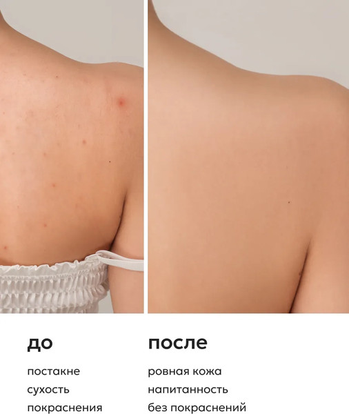Изображение товара Гель для душа Likato Professional Acne Control уход за проблемной кожей (250мл)