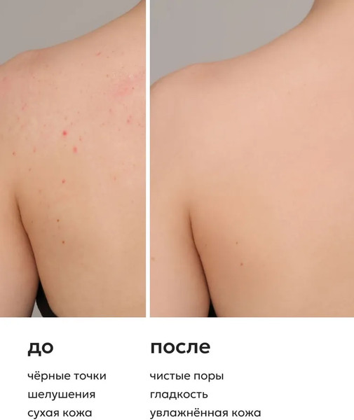 Изображение товара Молочко для тела Likato Professional от акне и черных точек с регенерирующим эффектом (250мл)