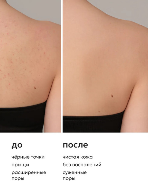 Изображение товара Гель для душа Likato Professional Acne Control от прыщей на теле (250мл)