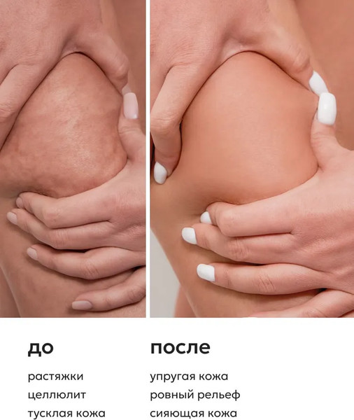 Изображение товара Масло для тела Likato Professional My Skulptor против растяжек (200мл)