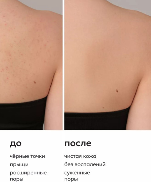 Изображение товара Гель для душа Likato Professional от акне и черных точек с регенерирующим эффектом (250мл)