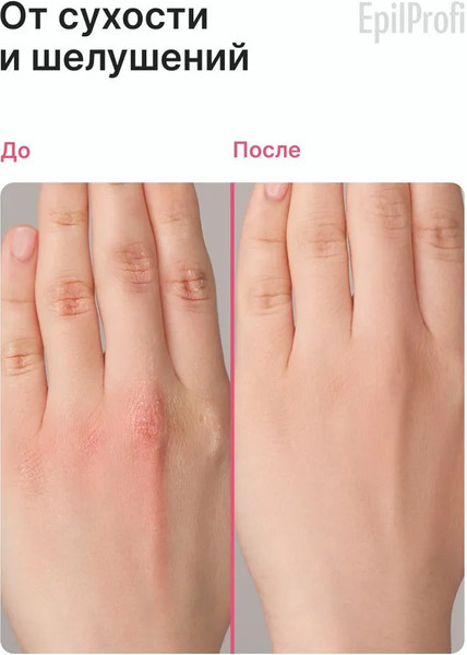 Изображение товара Крем для тела EpilProfi для очень сухой и обезвоженной кожи (100мл)